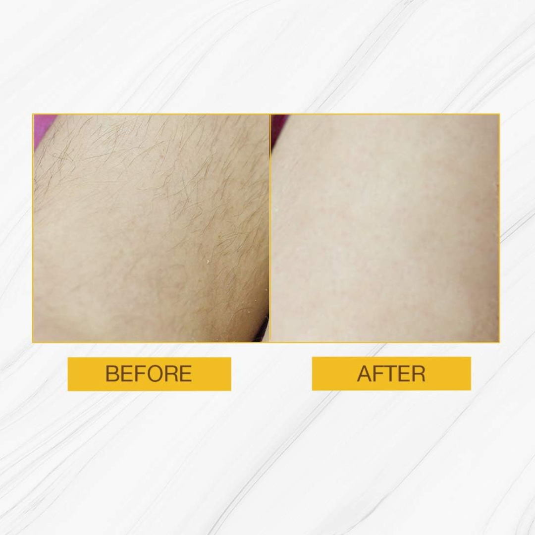 Gigi | Hair Removal Strips for Body